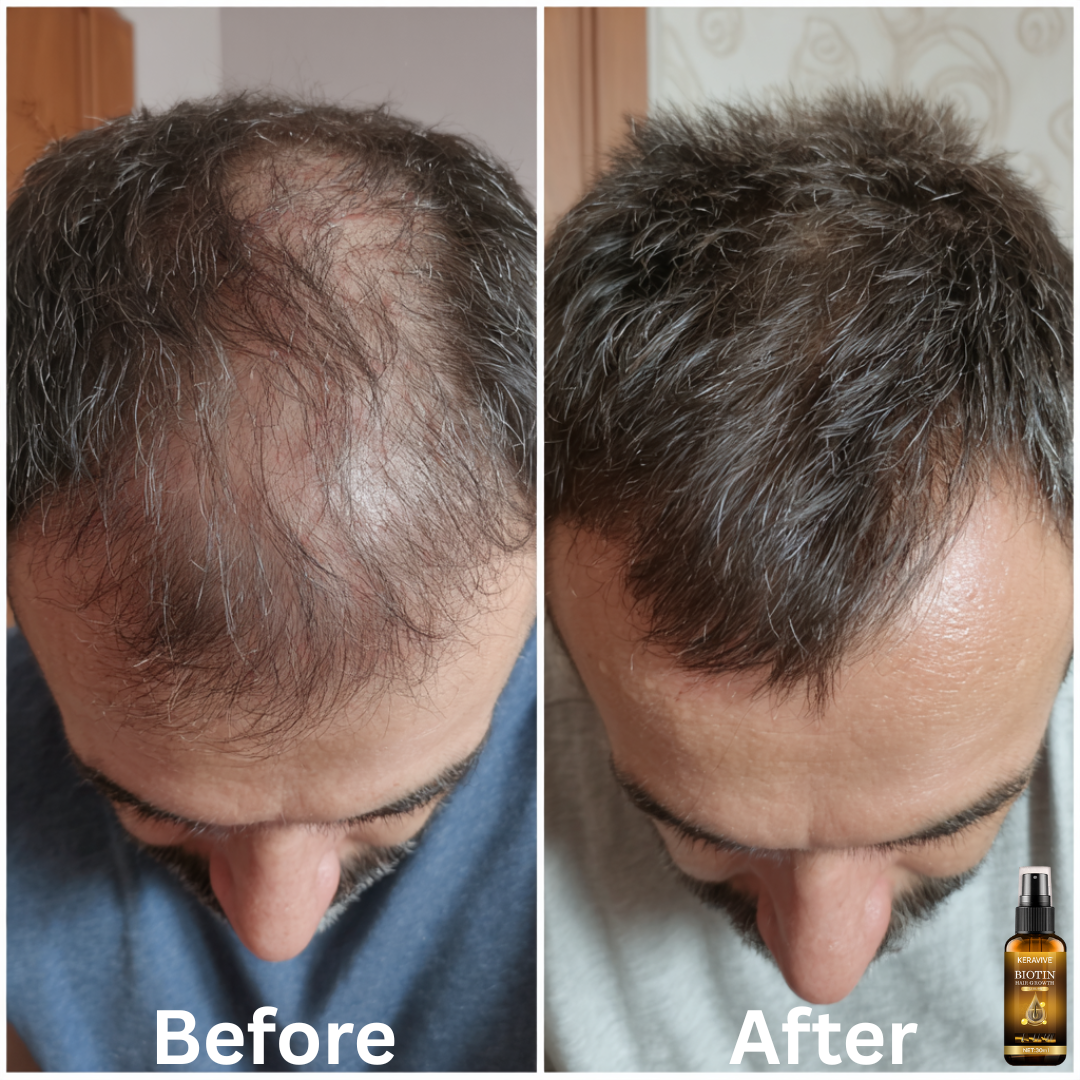 KeraVive™ Hair Growth Serum